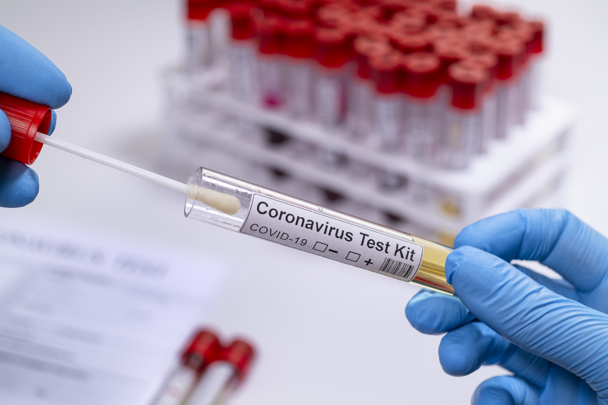 Rapid Antigen Test for Covid